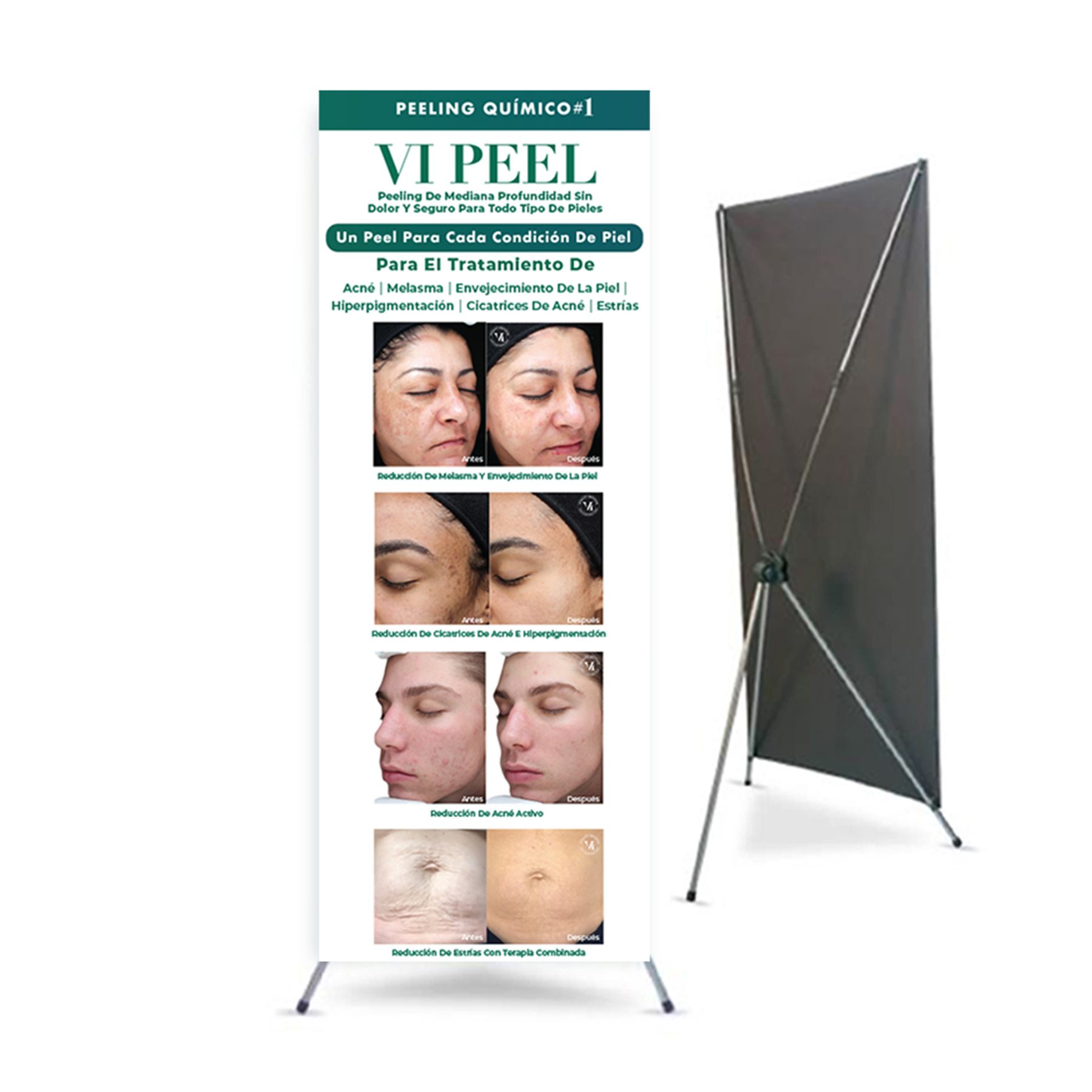 VI Peel Standing x Banner Practitioner's Office (Spanish)