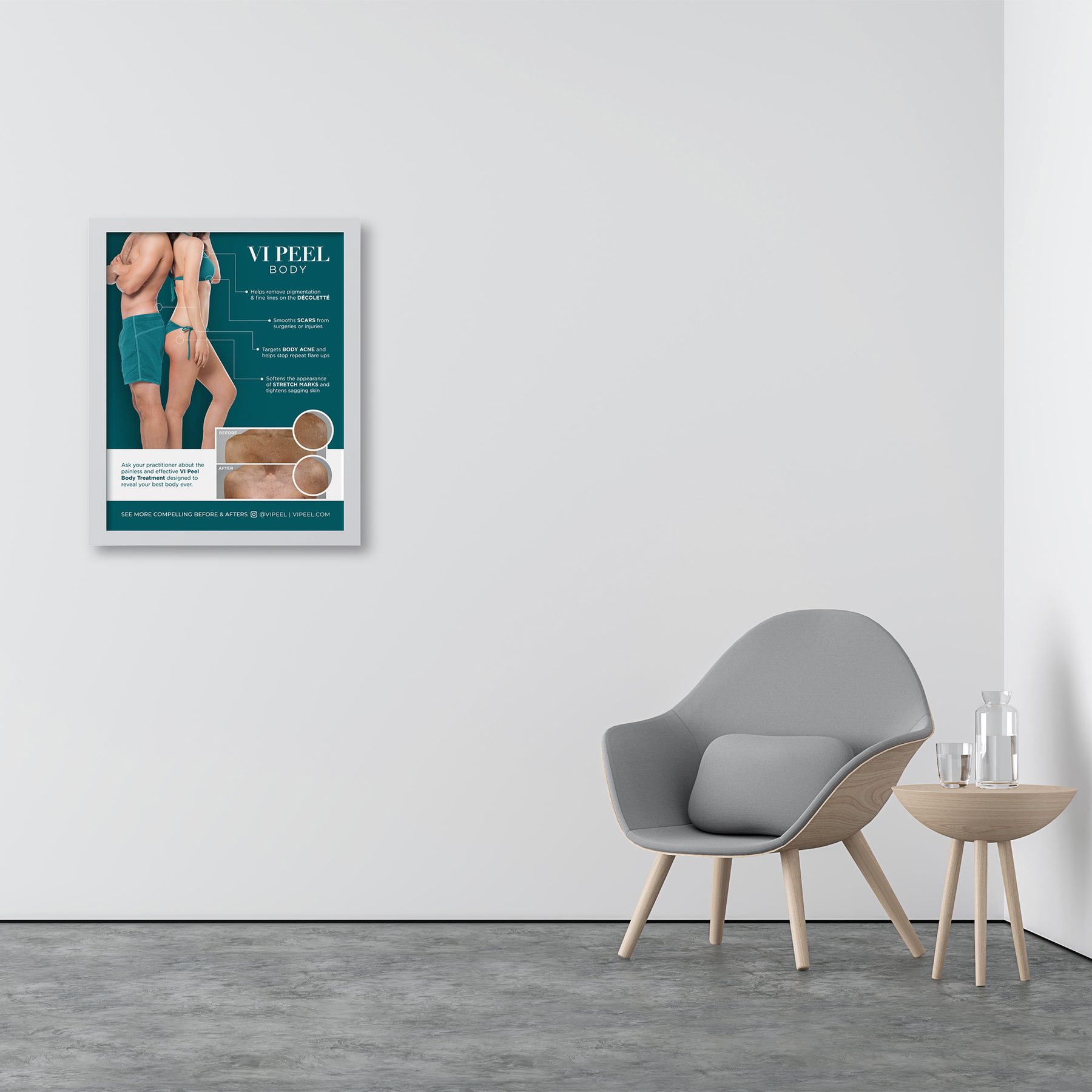 VI Peel Body Practitioners Office Poster