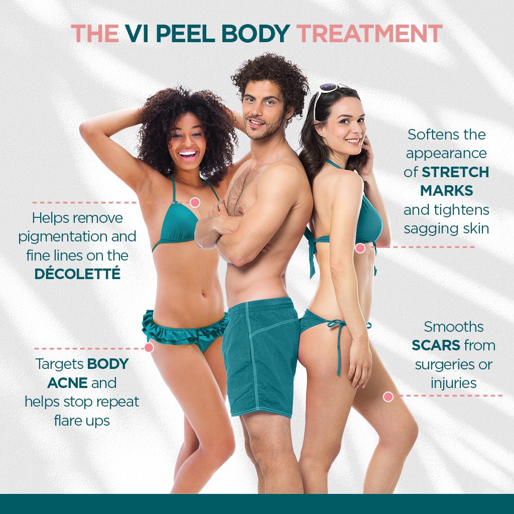 VI Peel Body Practitioners' Social Media Post