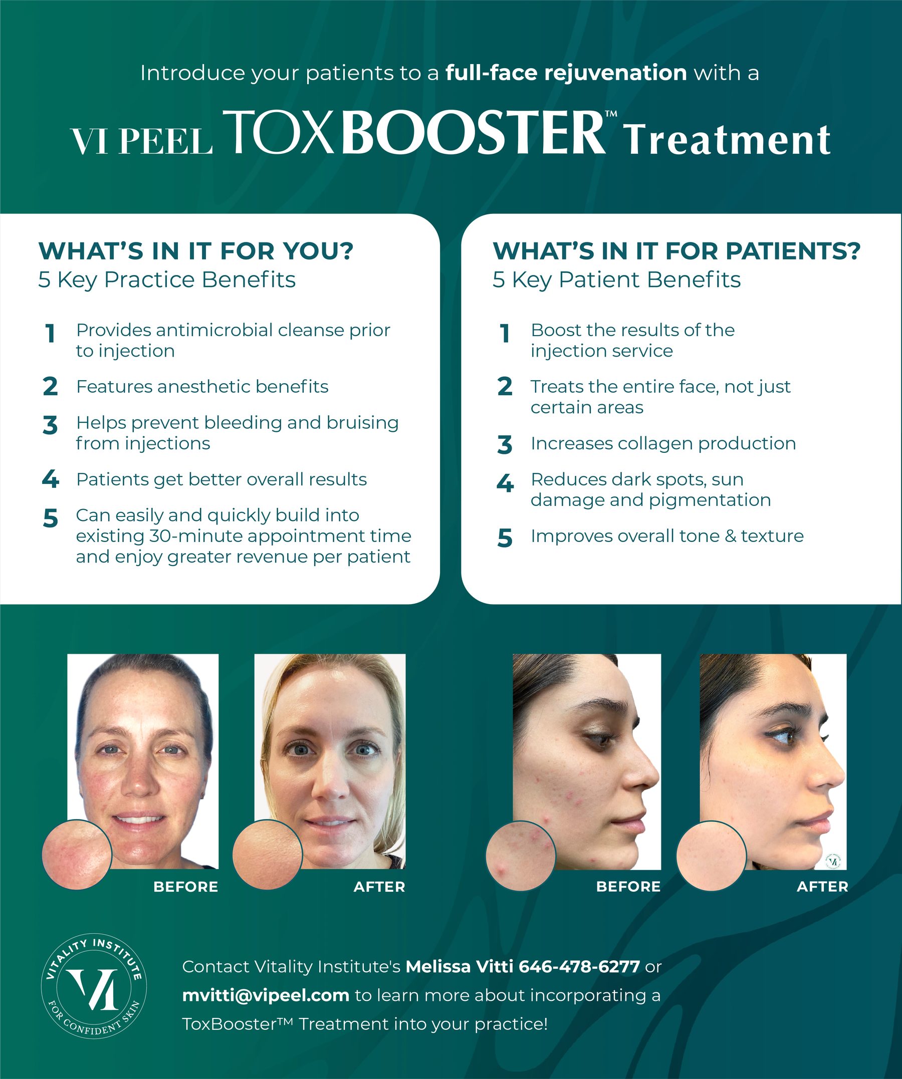ToxBooster Treatment