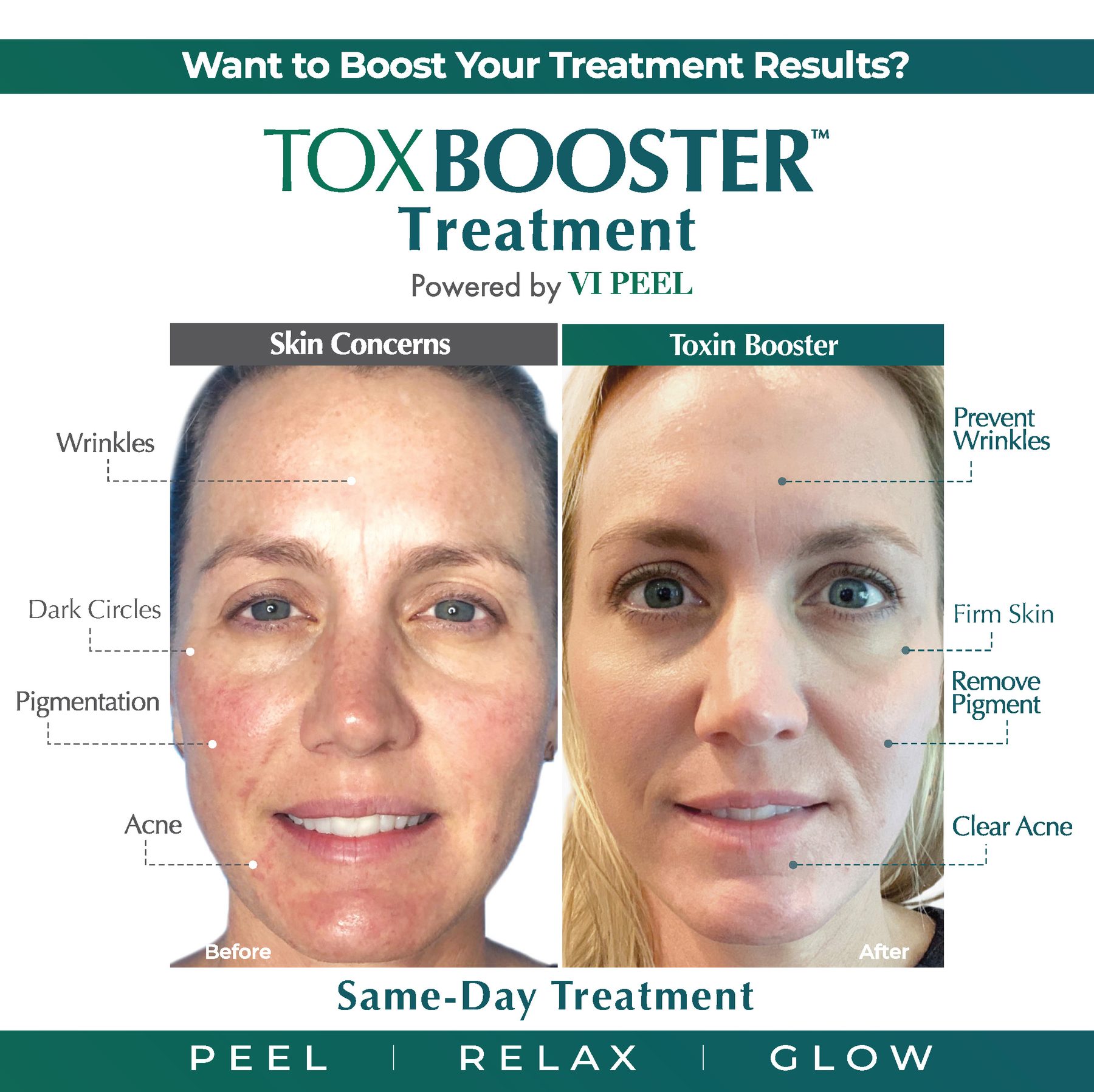 ToxBooster Treatment